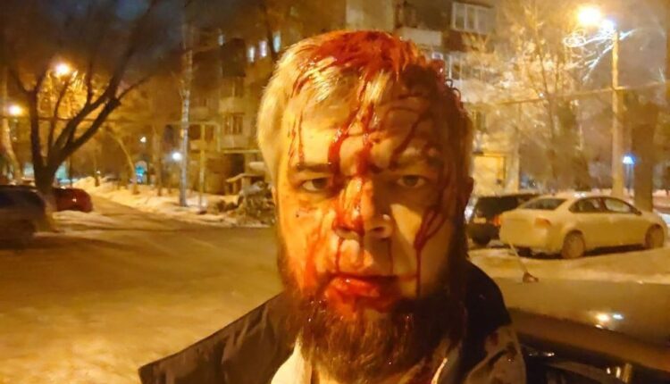 В Челябинске жестоко избит правозащитник Николай Кошман